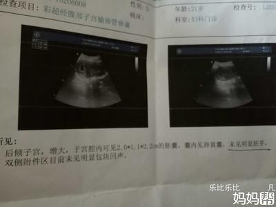 没怀孕孕酮高不来月经