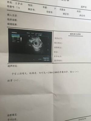 怀孕七个月能打胎吗