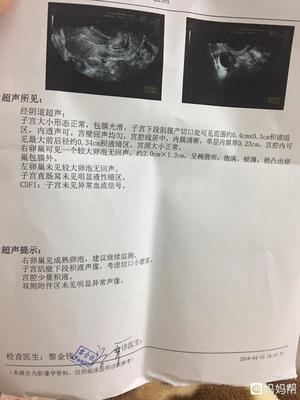 人流后排卵期