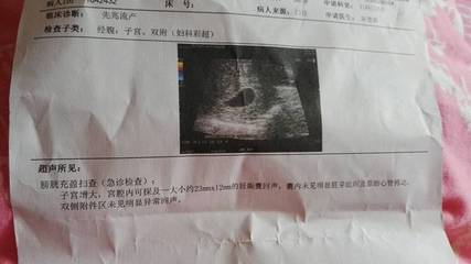 怀孕会出血嘛