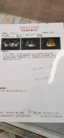 三维四维彩超几个月做