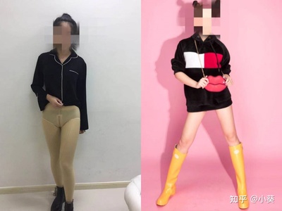 男生瘦臀抽脂