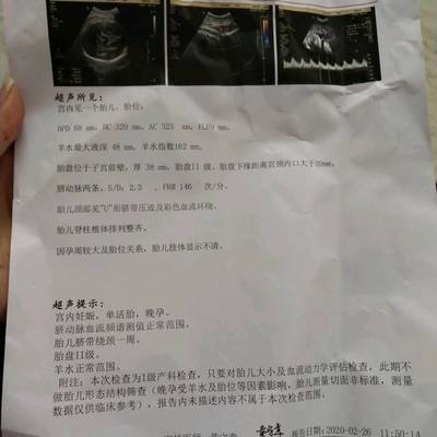 宝宝多重正常