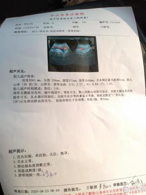 孕32周羊水多少正常