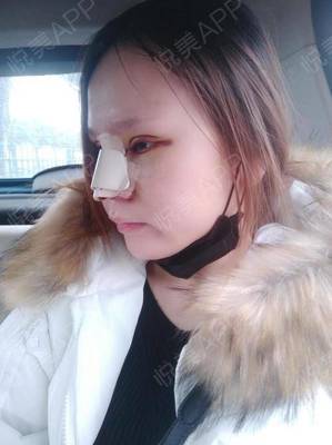 广西眼部整形