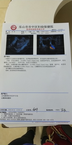 人流后两个月没来月经