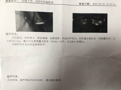 去医院检查是否怀孕要空腹吗