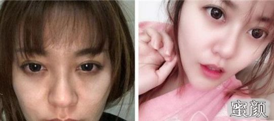 让痘痘发出来