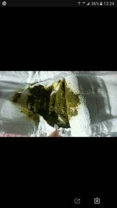 宝宝拉黑粑粑