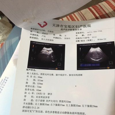 如何检查胎儿是否入盆