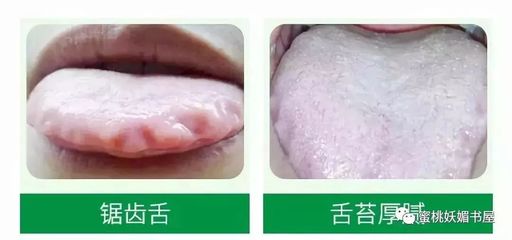 舌苔没了是怎么回事