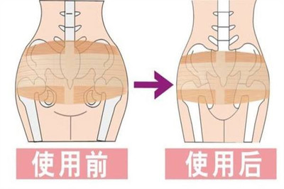 坐月子胯骨疼是怎么回事