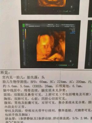 胎儿什么时候长的最快