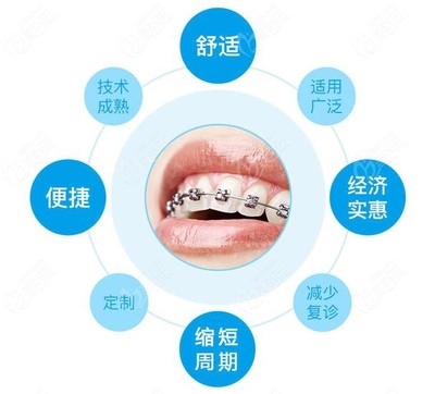 牙齿矫正好处