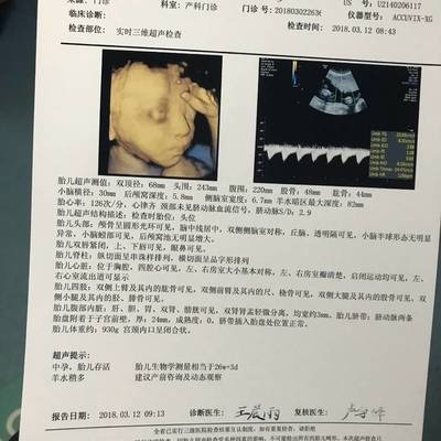 怀孕四个月胎动不明显正常吗