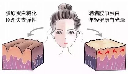 胶原蛋白都痘痘有用吗