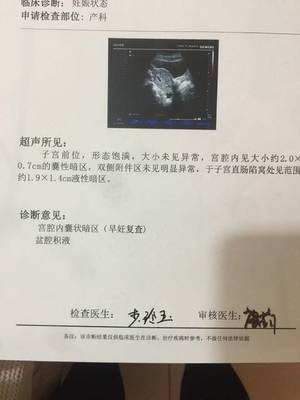多囊怀孕