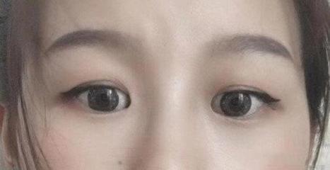双眼皮开眼角哪里好
