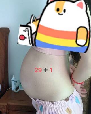 中年背部长痘痘是什么原因