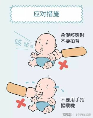 一岁宝宝咳嗽严重怎么办