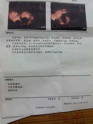宫颈糜烂两度怎么治疗