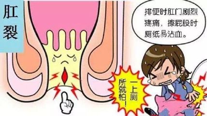 直肠疼痛是怎么回事
