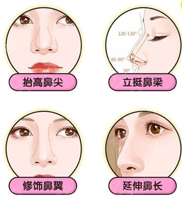 隆鼻可以侧身睡觉吗