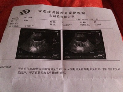 怀孕6周彩超图片