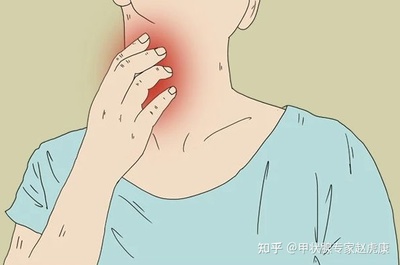 桥本甲亢怎么治疗最好