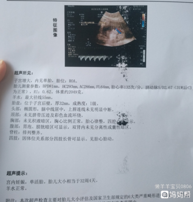 32周胎宝宝