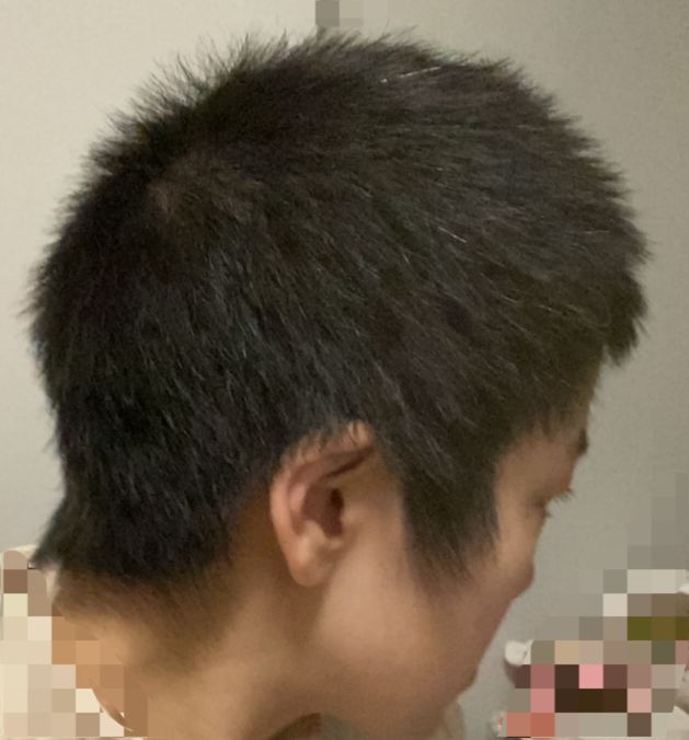 三个月头发长多长