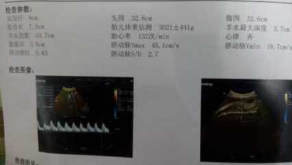 孕36周后胎儿一周一般能长重