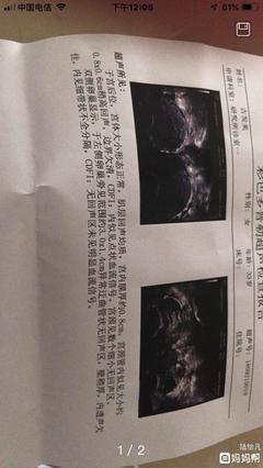 输卵管有积液是怎么回事