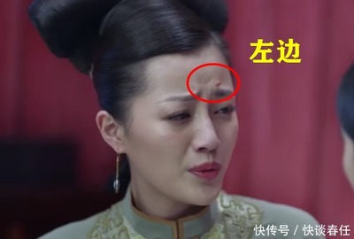 身上长痦子是怎么回事