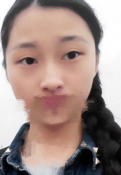 内双算双眼皮基因吗