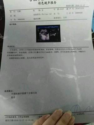 怀孕半个月会流产吗
