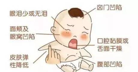 宝宝轮状病毒症状