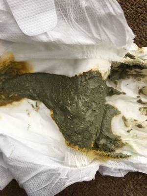 宝宝拉绿便怎么办