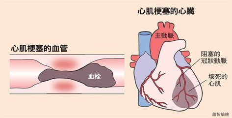 左心有点疼是怎么回事