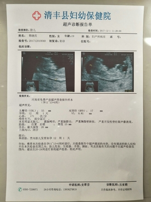 胎儿心率快