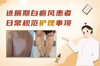 白癜风该怎么治疗好