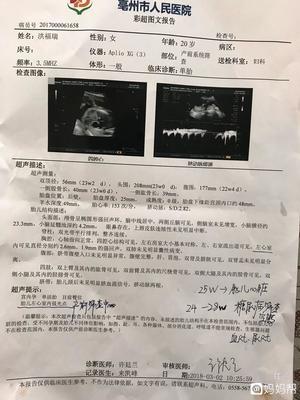 5个月胎儿一直动个不停