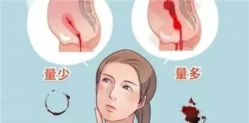 为什么一个月不来月经