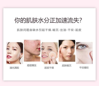 痘痘皮肤 该怎么蒸脸