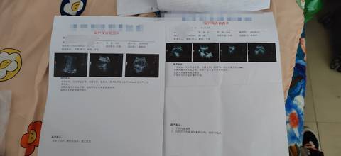 怀孕几周能用验孕棒测出来