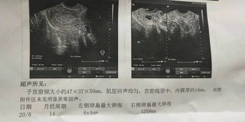 卵泡多大容易怀孕