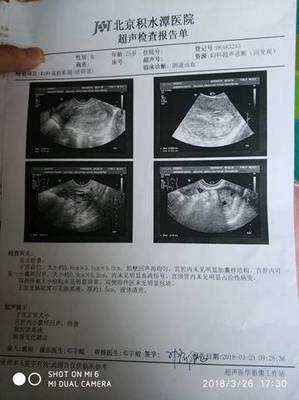 怀孕生化怎么办