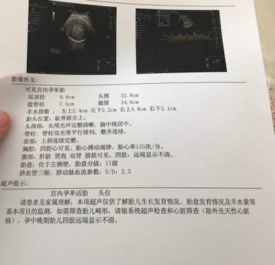 怀孕39周还没入盆正常吗