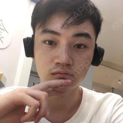 脂肪填充后下巴长痘痘