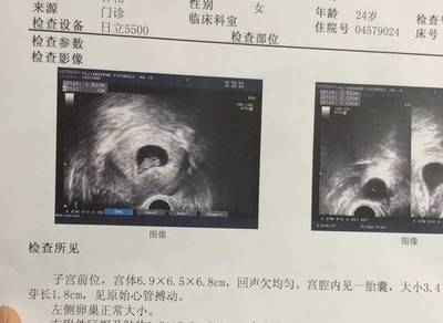 怀孕十一周有什么症状